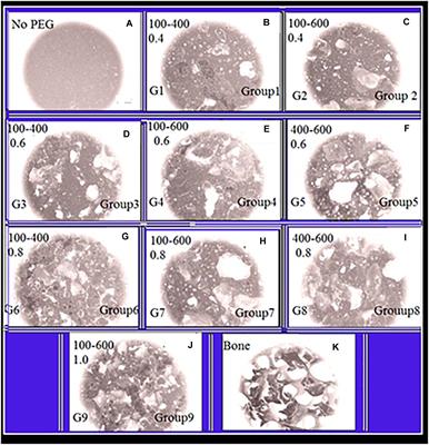 Scaffolds of Macroporous Tannin Spray With Human-Induced Pluripotent Stem Cells